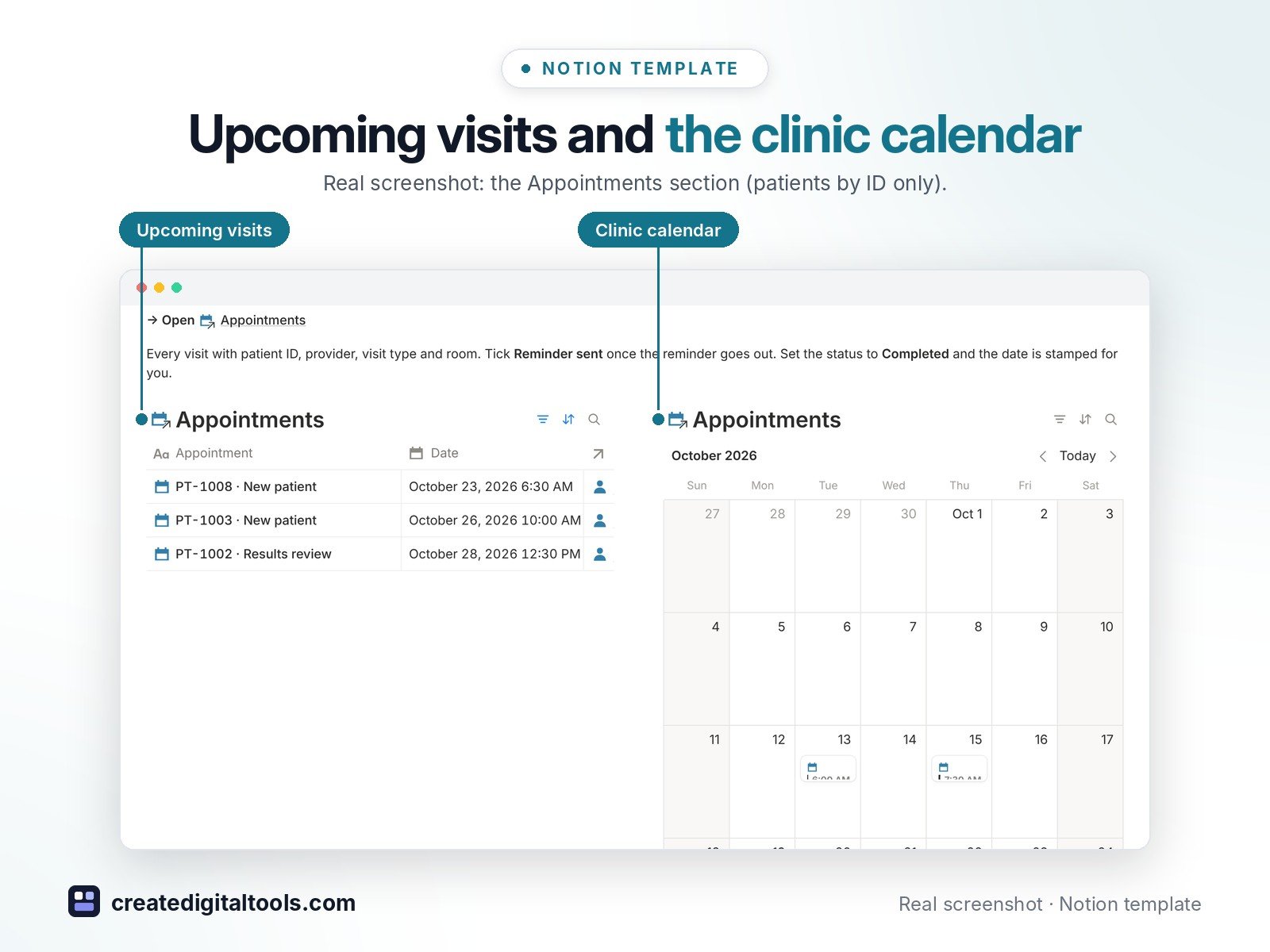 Healthcare Practice Management OS Notion template: Upcoming visits and the clinic calendar. Real screenshot: the Appointments section (patients by ID only).